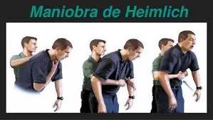 Maniobra de Heimlich