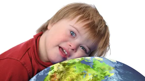 Niño con Síndrome de Down
Foto: Peppapig47