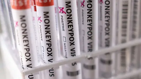 Pruebas etiquetadas como "positivas" por viruela del mono (monkeypox, en inglés) 
Foto: REUTERS/DADO RUVIC/ILLUSTRATION