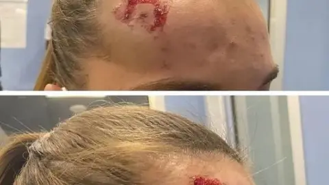 Víctima de agresión de un cliente en una heladería de Valdepeñas