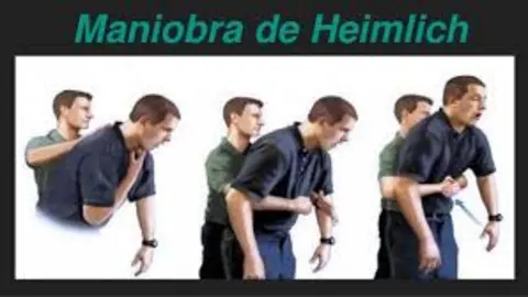 Maniobra de Heimlich