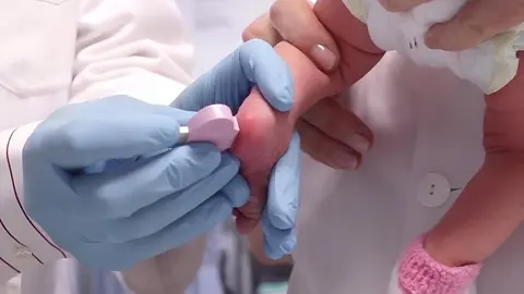 Prueba del tal&oacute;n